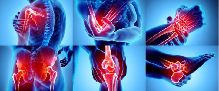 Iekaisušas locītavas